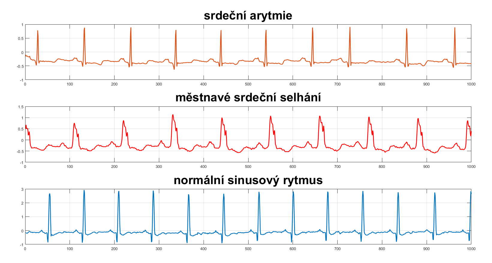Srdeční rytmus